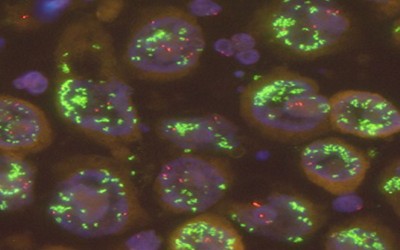 MET – ein vielversprechendes Target